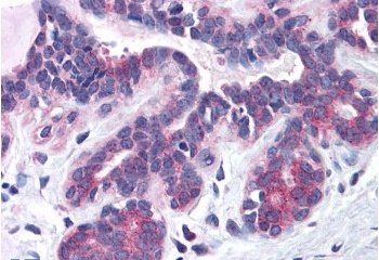 Goat anti-SNX16 Antibody