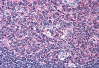 Goat anti-SNX16 Antibody