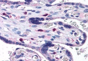 Goat anti-SNX16 Antibody