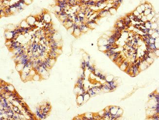SNX18 Antibody