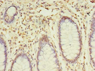 SNX24 Antibody