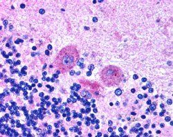 SNX26/TCGAP (C Terminus) Antibody