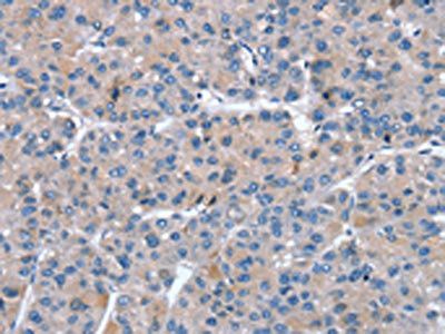 SNX27 Antibody