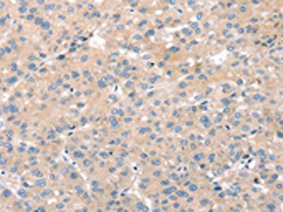 SNX29 antibody