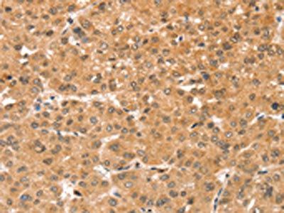 SNX30 Antibody