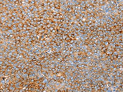 SNX33 Antibody