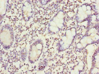 SNX7 Antibody