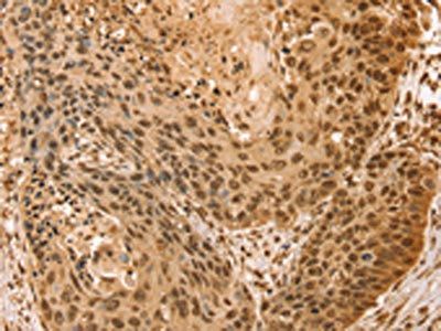 SNX8 Antibody