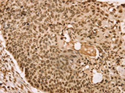 SNX8 Antibody