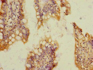 SOAT2 Antibody