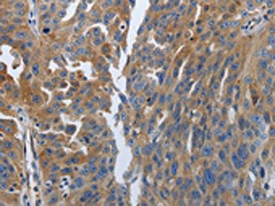 SOCS1 antibody