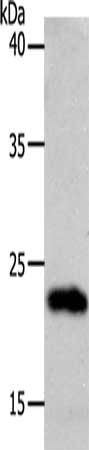 SOCS1 Antibody