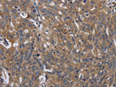 SOCS1 Antibody