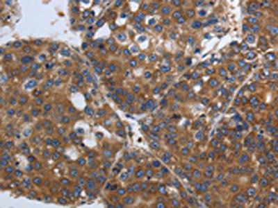 SOCS1 Antibody