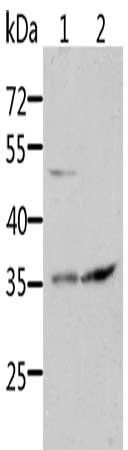 SOCS1 antibody