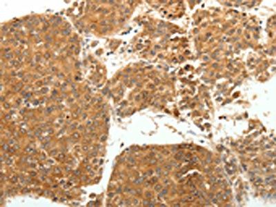 SOCS3 Antibody