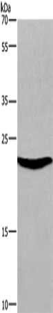 SOCS3 antibody