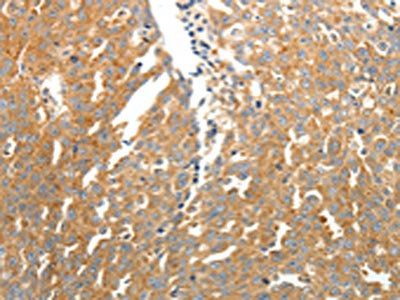 SOCS3 Antibody