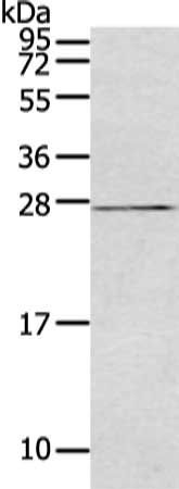 SOCS3 Antibody