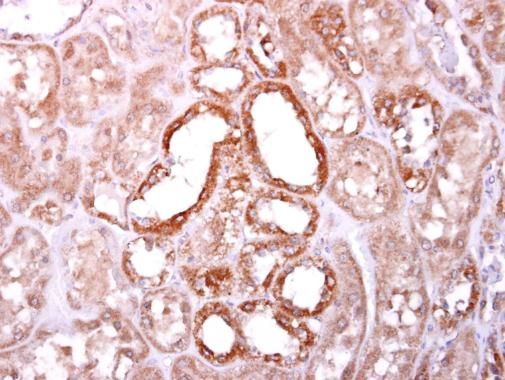 SOCS4 antibody [C3], C-term