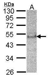 SOCS4 antibody [C3], C-term