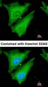 SOCS4 Rabbit Polyclonal Antibody