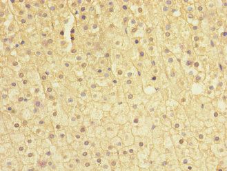 SOCS5 Antibody
