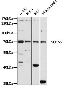 SOCS5 antibody