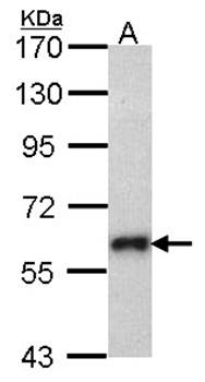 SOCS5 antibody