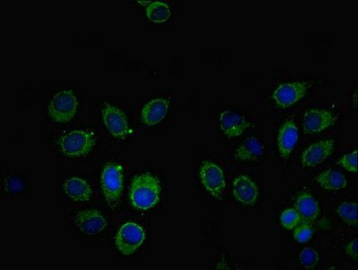 SOCS6 Antibody