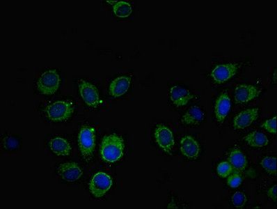 SOCS6 antibody