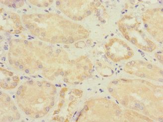 SOCS6 antibody