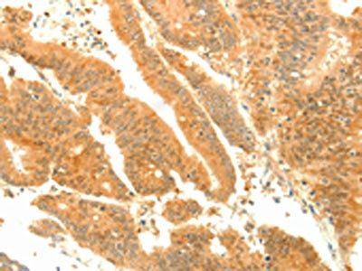 SOCS6 Antibody