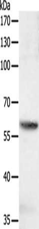 SOCS6 antibody