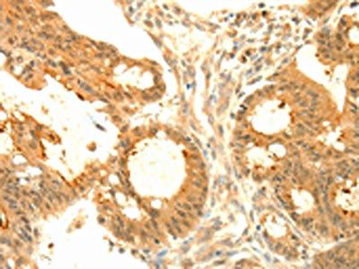 SOCS6 Antibody