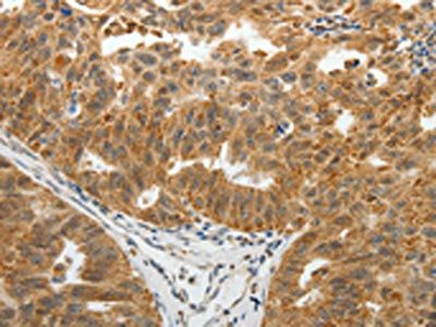 SOCS7 Antibody