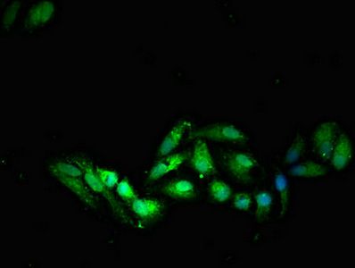 SOCS7 antibody