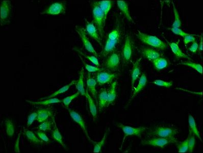 SOD2 Antibody