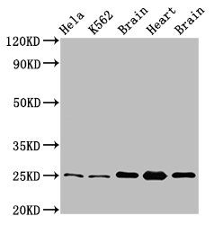 SOD2 Antibody