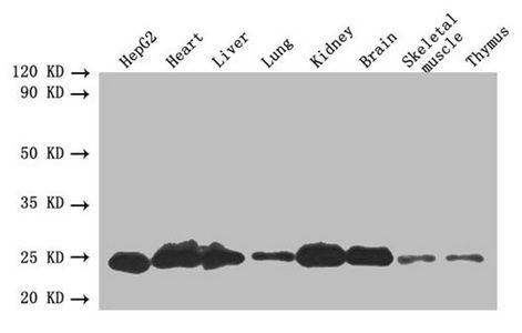 SOD2 Antibody