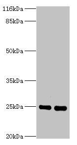 SOD2 antibody