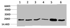 SOD2 Antibody