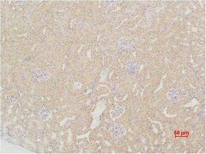 SOD2 Antibody