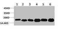 SOD2 Antibody