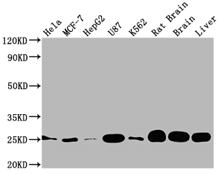 SOD2 Recombinant Monoclonal Antibody