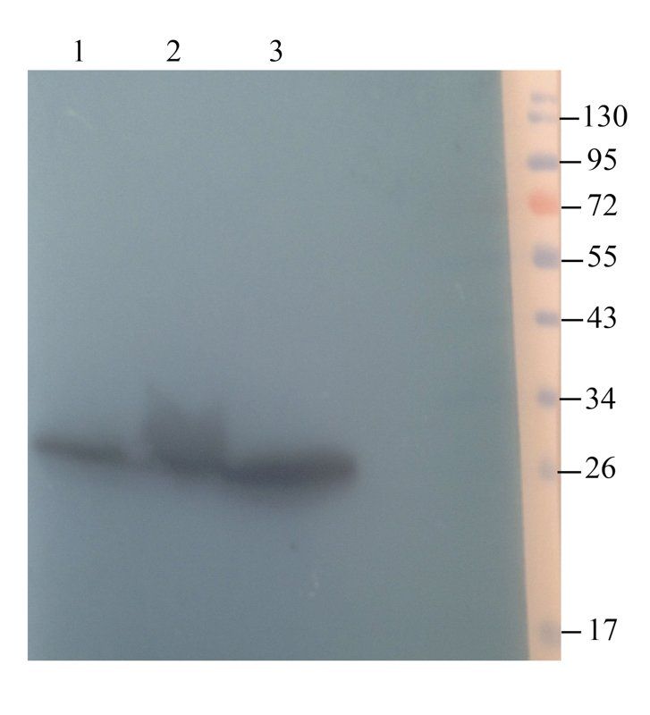 SOD2 Rabbit Polyclonal Antibody