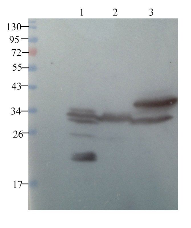 SOD2 antibody