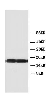 Superoxide Dismutase 1/SOD1 Antibody