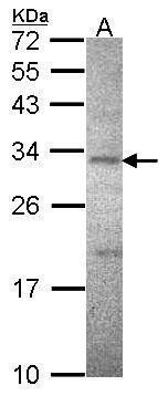 Sodium/Potassium ATPase beta 3 antibody