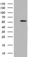 Sorbitol Dehydrogenase Antibody